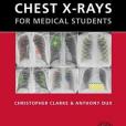 Chest X-Rays for Medical Students Chest X-Rays for Medical Students