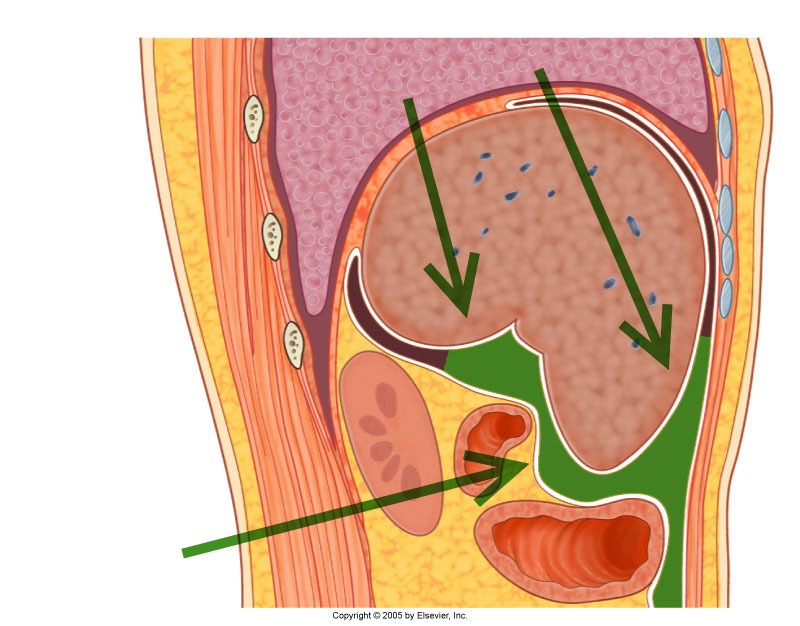肝腎隱窩
