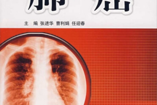 肺癌(2007年軍事醫學科學出版社出版的圖書) 肺癌(2007年軍事醫學科學出版社出版的圖書)