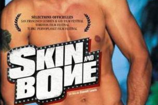 皮與骨(Skin and Bone) 皮與骨(Skin and Bone)