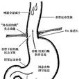 胃總酸度 胃總酸度