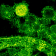中東呼吸系統綜合徵冠狀病毒(MERS-CoV) 中東呼吸系統綜合徵冠狀病毒(MERS-CoV)