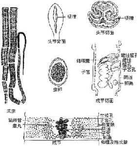 闊節裂頭絛蟲病