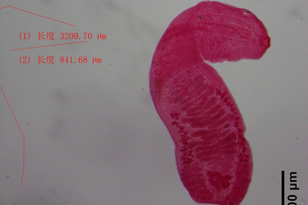 腸背孔吸蟲 腸背孔吸蟲
