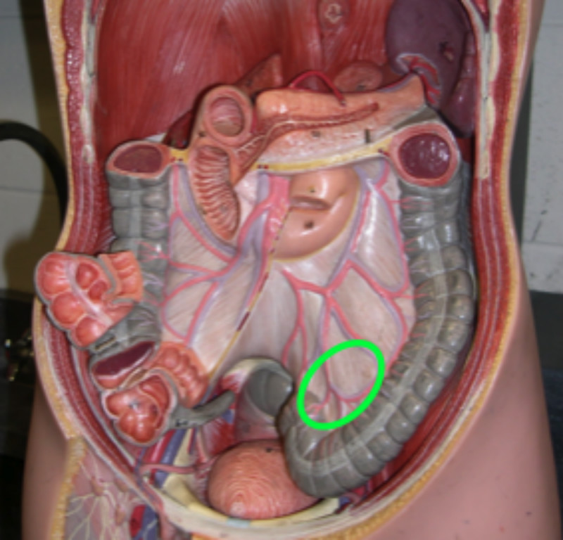 乙狀結腸系膜
