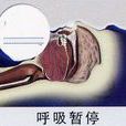 呼吸暫停