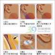 拉皮術 拉皮術