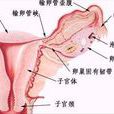 輸卵管傘