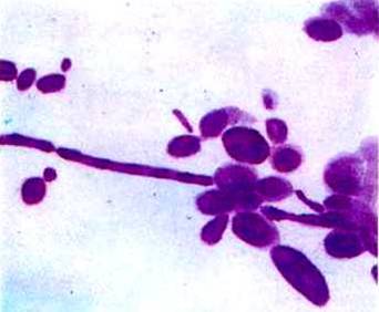 白假絲酵母菌