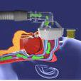 CPAP