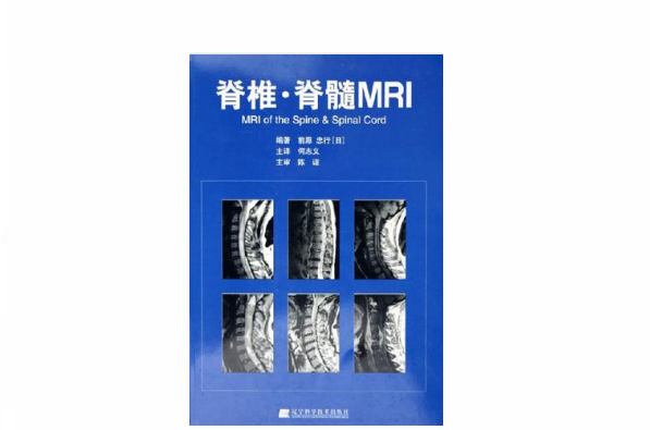 脊椎·脊髓MRI