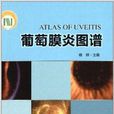 葡萄膜炎圖譜 葡萄膜炎圖譜