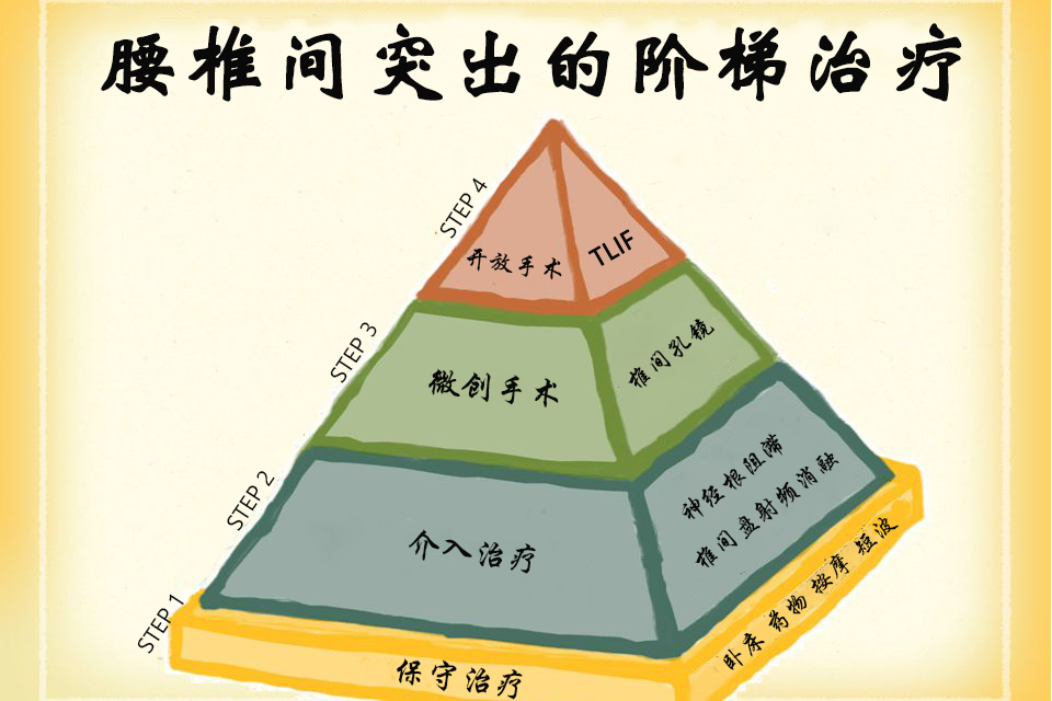 階梯治療 階梯治療