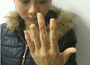 9·17甘肅女子被民警打傷事件
