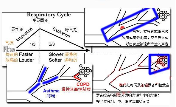 囉音 羅音 種類 病因 乾囉音 濕囉音 乾囉音的發生機制 乾囉音的分類 濕囉音的 中文百科全書