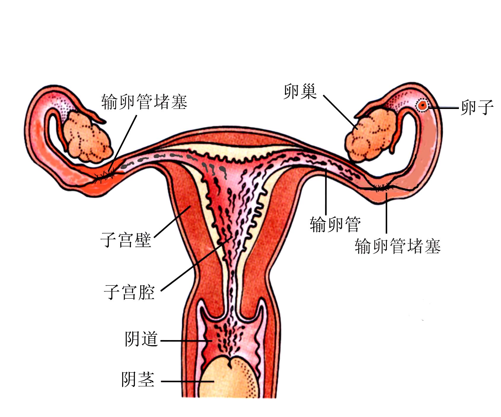 輸卵管