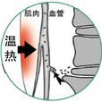 熱療法