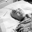 小兒腦腫瘤 小兒腦腫瘤
