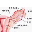 子宮乏力 子宮乏力