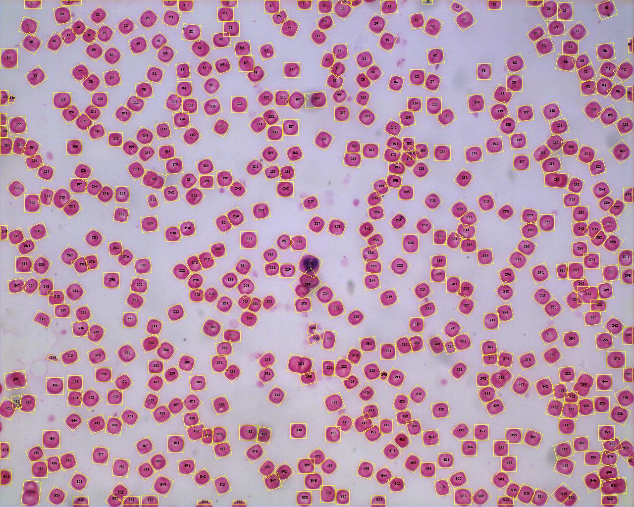 紅細胞計數(紅細胞數)
