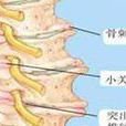 椎前旁軟組織腫脹或膿腫