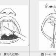 齶大孔 齶大孔