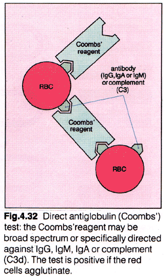 紅細胞與冷凝集素抗體凝集示意圖