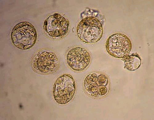 人類胚胎幹細胞