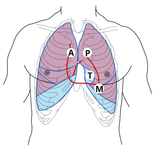 圖3 胸部的5個聽診區