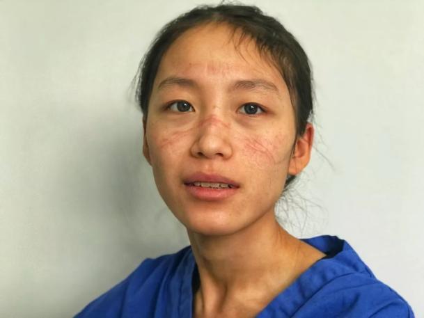 陳穎(浙江大學醫學院附屬第四醫院感染科病房護士) 陳穎(浙江大學醫學院附屬第四醫院感染科病房護士)