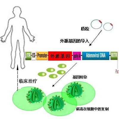 基因治療