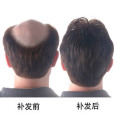 無痕增發 無痕增發