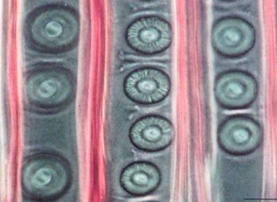 管胞細胞壁上的具緣紋孔