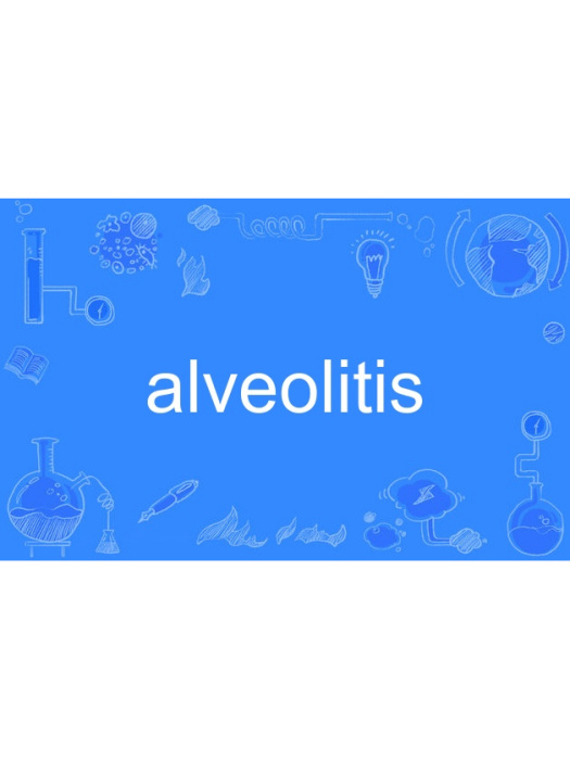 alveolitis alveolitis