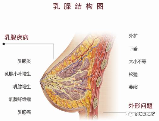 乳腺增生纖維瘤