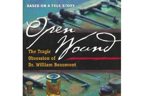 open wound the tragic obsession of dr. w open wound the tragic obsession of dr. w