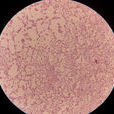綠膿桿菌(寄主細胞)