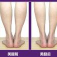小腿吸脂 小腿吸脂