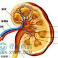 交叉性異位腎