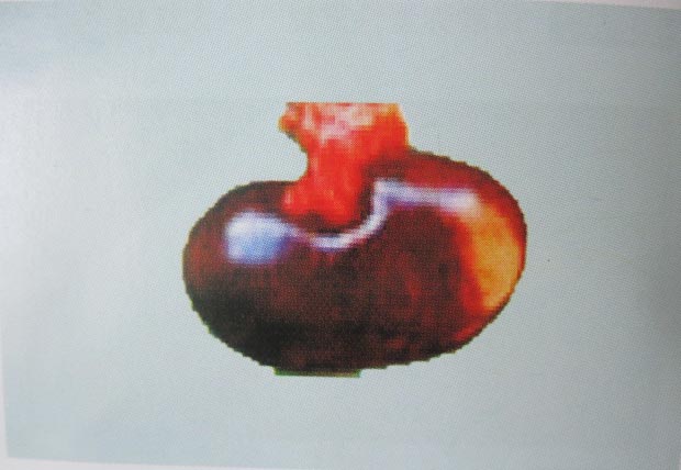 圖2 大紫腎