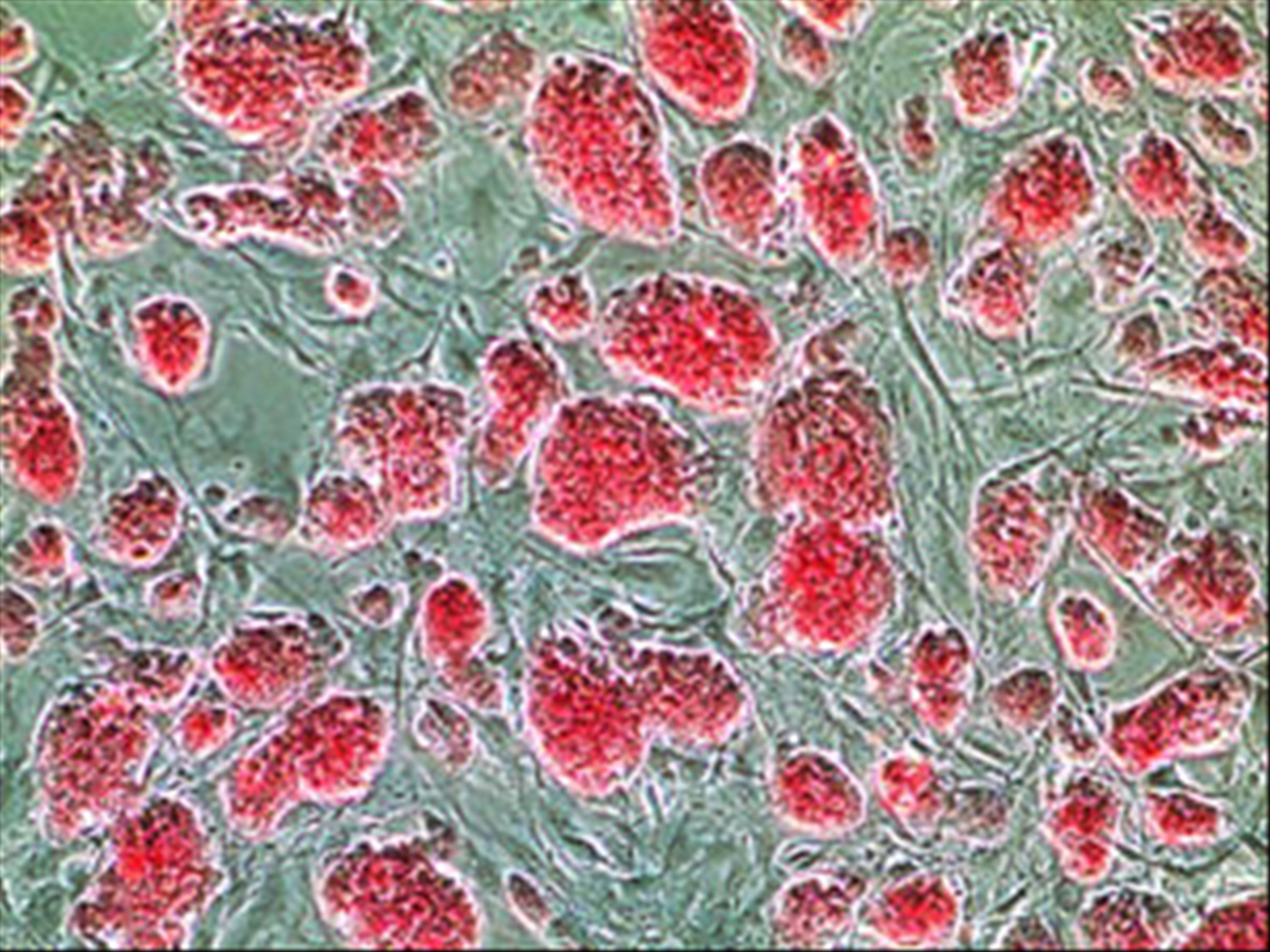 胎盤造血幹細胞