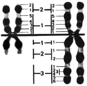 染色體異常核型Ⅱ