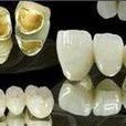 鈀金烤瓷牙 鈀金烤瓷牙
