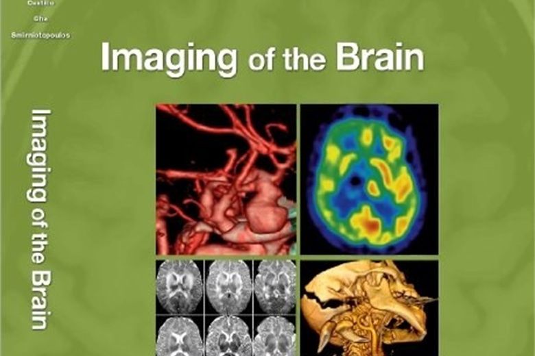Imaging of the Brain Imaging of the Brain