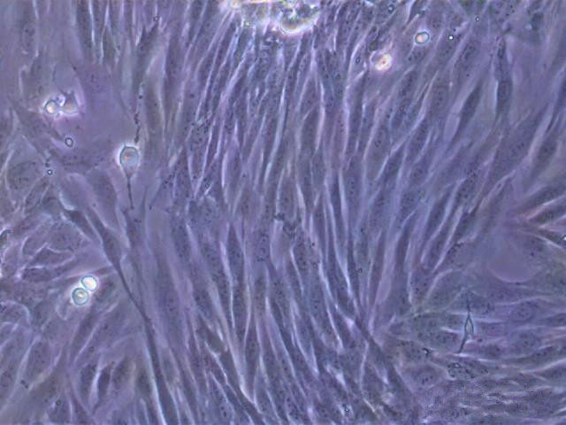 纖維細胞