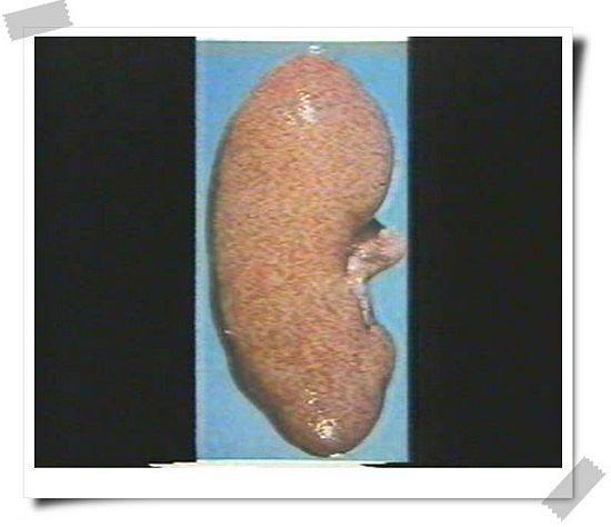 蚤咬腎 蚤咬腎