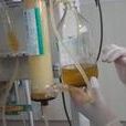 小兒急性腎炎