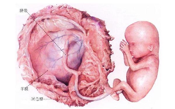胎糞污染