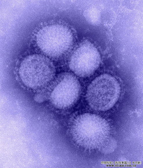 H1N1甲型流感暴發