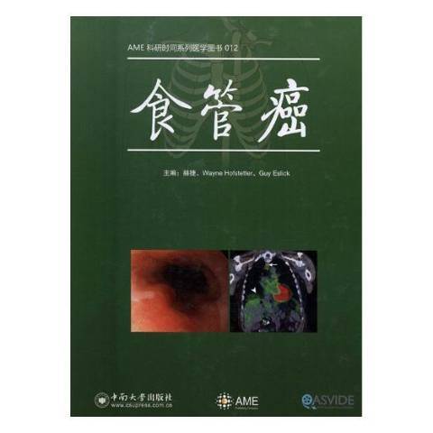 食管癌(2016年中南大學出版社出版的圖書) 食管癌(2016年中南大學出版社出版的圖書)